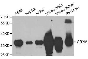 Western Blotting (WB) image for anti-Crystallin, mu (CRYM) (AA 1-314) antibody (ABIN1679371)