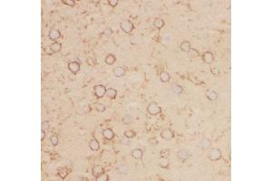 Immunohistochemistry (IHC) image for anti-Potassium Voltage-Gated Channel, Shab-Related Subfamily, Member 1 (KCNB1) (AA 687-858) antibody (ABIN3043866)