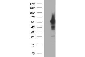 Image no. 1 for anti-Tyrosine Hydroxylase (TH) antibody (ABIN1501369) (Tyrosine Hydroxylase Antikörper)