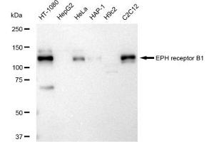 Western blotting analysis using EPH receptor B1 antibody (ABIN7798455). (Rekombinanter EPH Receptor B1 Antikörper)