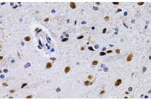 Immunohistochemistry of paraffin-embedded Rat brain using ID3 Polyclonal Antibody at dilution of 1:200 (40x lens). (ID3 Antikörper)