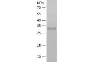 NMRAL1 Protein (AA 1-299) (His tag)