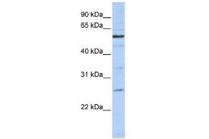 ZGPAT antibody used at 1 ug/ml to detect target protein. (ZGPAT Antikörper  (C-Term))