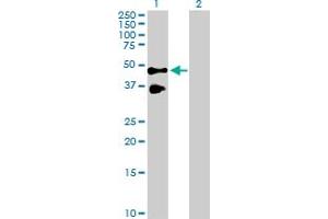 Western Blot analysis of TNFRSF10B expression in transfected 293T cell line by TNFRSF10B MaxPab polyclonal antibody. (TNFRSF10B Antikörper  (AA 1-440))