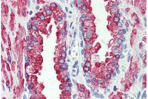 Prostate, Human: Formalin-Fixed, Paraffin-Embedded (FFPE) (GPR146 Antikörper  (Internal Region))