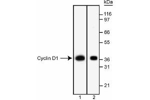 Western blot analysis of Cyclin D1.