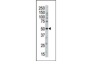 Image no. 1 for anti-Protein Kinase, AMP-Activated, gamma 3 Non-Catalytic Subunit (PRKAG3) (Middle Region) antibody (ABIN359119)