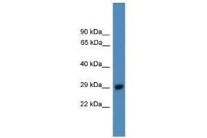 Western Blotting (WB) image for anti-Proteasome (Prosome, Macropain) 26S Subunit, Non-ATPase, 9 (PSMD9) (C-Term) antibody (ABIN929206)