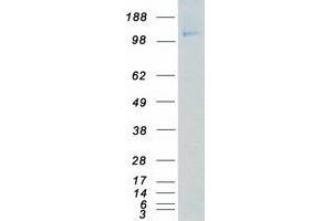 Validation with Western Blot (PDGFRB Protein (Myc-DYKDDDDK Tag))
