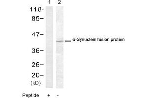 Image no. 1 for anti-Synuclein, alpha (SNCA) (Ser129) antibody (ABIN319324) (SNCA Antikörper  (Ser129))