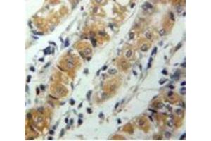 Used in DAB staining on fromalin fixed paraffin-embedded Stomach tissue (CXCL17 Antikörper  (AA 24-119))