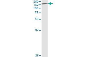 Western Blotting (WB) image for anti-Tyrosine Kinase 2 (TYK2) (AA 276-375) antibody (ABIN598992) (TYK2 Antikörper  (AA 276-375))