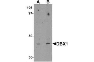 Western blot analysis of DBX1 in mouse kidney tissue lysate with DBX1 antibody at (A) 1 and (B) 2 μg/mL. (DBX1 Antikörper  (Middle Region))