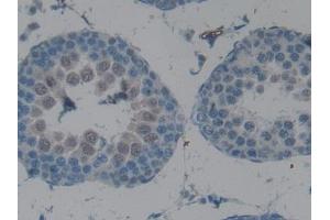 DAB staining on IHC-P; Samples: Rat Testis Tissue (CPB2 Antikörper  (AA 164-417))
