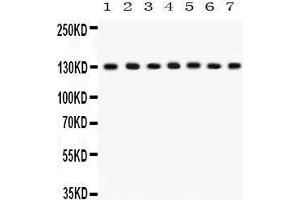 Western Blotting (WB) image for anti-Discs, Large Homolog 1 (DLG1) (AA 1-165) antibody (ABIN3043562) (DLG1 Antikörper  (AA 1-165))