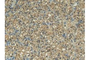 Immunohistochemistry (IHC) image for anti-Matrix Metallopeptidase 13 (Collagenase 3) (MMP13) (AA 103-290) antibody (ABIN7430978)