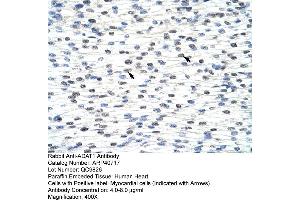 Rabbit Anti-ADAT1 Antibody  Paraffin Embedded Tissue: Human Heart Cellular Data: Myocardial cells Antibody Concentration: 4. (ADAT1 Antikörper  (C-Term))