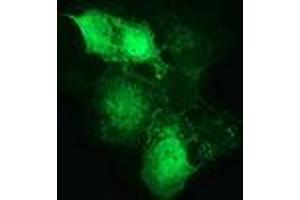 Anti-CTNNB1 mouse monoclonal antibody (ABIN2454138) immunofluorescent staining of COS7 cells transiently transfected by pCMV6-ENTRY CTNNB1 (RC208947). (CTNNB1 Antikörper)
