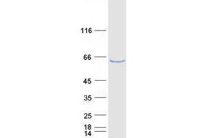 Western Blotting (WB) image for Enhancer of mRNA Decapping 3 (EDC3) (Transcript Variant 3) protein (Myc-DYKDDDDK Tag) (ABIN2719930)