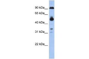 WB Suggested Anti-CCDC144B Antibody Titration: 0. (CCDC144B Antikörper  (Middle Region))