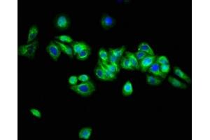 Immunofluorescence staining of HepG2 cells with ABIN7144697 at 1:133, counter-stained with DAPI. (Arylsulfatase H Antikörper  (AA 449-529))