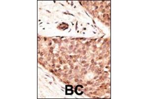 Immunohistochemistry (Paraffin-embedded Sections) (IHC (p)) image for anti-Caudal Type Homeobox 2 (CDX2) (AA 1-30), (N-Term) antibody (ABIN390076)