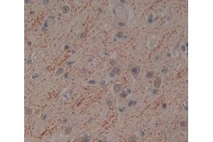 Used in DAB staining on fromalin fixed paraffin- embedded brain tissue (NT5M Antikörper  (AA 38-228))