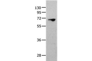 Western Blot analysis of 823 cell using MMP25 Polyclonal Antibody at dilution of 1:1300