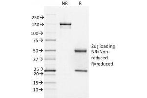 SDS-PAGE Analysis of Purified, BSA-Free FOXA1 Antibody (clone FOXA1/1518). (FOXA1 Antikörper  (AA 372-472))