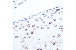 Immunohistochemistry of paraffin-embedded rat bone marrow using ALDOA Rabbit mAb (ABIN7265550) at dilution of 1:100 (40x lens). (ALDOA Antikörper)