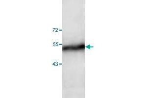 Western blot analysis of human fetal liver tissue lysate with ADAM15 polyclonal antibody  at 1:200 dilution.