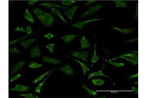 Immunofluorescence of monoclonal antibody to ERCC2 on HeLa cell. (ERCC2 Antikörper  (AA 1-405))