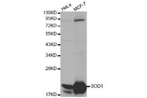 Western blot analysis of extracts of various cell lines, using SOD1 antibody. (SOD1 Antikörper  (AA 1-154))