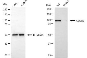 Western blotting analysis using ASCC2 antibody (ABIN7797477). (ASCC2 Antikörper)