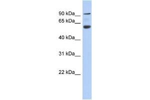 WB Suggested Anti-CENTB5 Antibody Titration: 0. (Acap3 Antikörper  (N-Term))