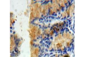 IHC-P analysis of Bowels tissue, with DAB staining.