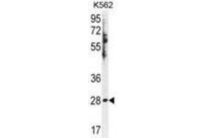 HSD11B1L Antibody Western blot analysis in K562 cell line lysates (35ug/lane). (HSD11B1L Antikörper  (C-Term))