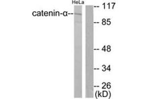 Western Blotting (WB) image for anti-Catenin (Cadherin-Associated Protein), alpha 1, 102kDa (CTNNA1) (AA 857-906) antibody (ABIN2879119) (CTNNA1 Antikörper  (AA 857-906))