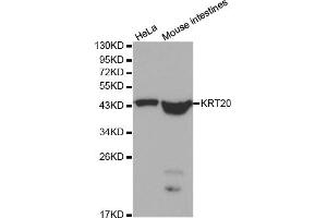 Western blot analysis of extracts of various cell lines, using KRT20 antibody. (KRT20 Antikörper)
