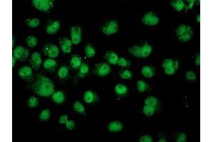 Anti-ASCC1 mouse monoclonal antibody (ABIN2455148) immunofluorescent staining of COS7 cells transiently transfected by pCMV6-ENTRY ASCC1 (RC201872). (ASCC1 Antikörper)