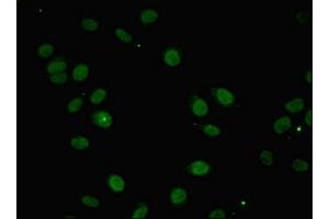 Immunofluorescent analysis of A549 cells using ABIN7156394 at dilution of 1:100 and Alexa Fluor 488-congugated AffiniPure Goat Anti-Rabbit IgG(H+L) (INTS1 Antikörper  (AA 451-710))