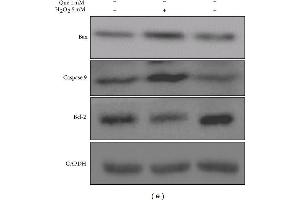 Effects of quercetin on cell apoptosis in H2O2-treated H9C2 cells. (Caspase 9 Antikörper)