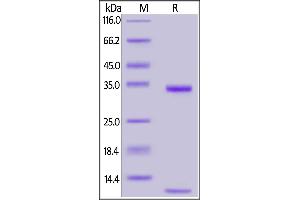 FCGRT & B2M (AA 24-297) protein (His tag)