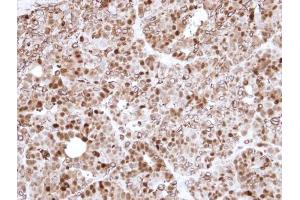 Immunohistochemistry (IHC) image for anti-Annexin A1 (ANXA1) antibody (ABIN2854920)
