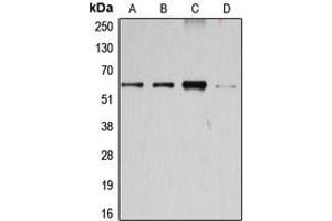 Western blot analysis of Cyclin B1 expression in Jurkat (A), K562 (B), HEK293T (C), HeLa (D) whole cell lysates. (Cyclin B1 Antikörper  (Center))