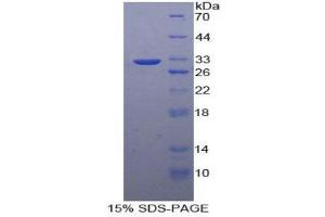 SDS-PAGE (SDS) image for Insulin-Like Growth Factor 2 Receptor (IGF2R) (AA 2167-2442) protein (His tag) (ABIN1877420)