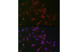 Immunofluorescence analysis of C6 cells using IL6ST antibody (ABIN7268003) at dilution of 1:100. (CD130/gp130 Antikörper  (AA 678-857))
