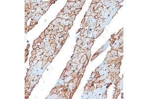 Immunohistochemistry (IHC) image for anti-Flotillin 1 (FLOT1) (AA 128-427) antibody (ABIN6140683)