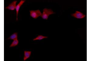 ABIN6264723 and ABIN6276884 staining HepG2 by IF/ICC.