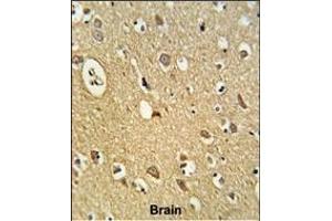 Formalin-fixed and paraffin-embedded human brain tissue reacted with OMD Antibody (C-term), which was peroxidase-conjugated to the secondary antibody, followed by DAB staining. (Osteomodulin Antikörper  (C-Term))
